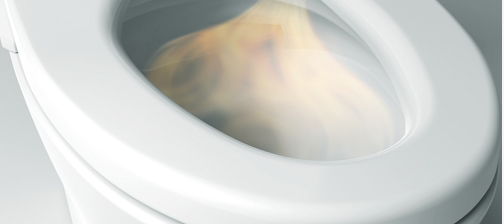 5 ĐIỀU BẠN CÓ THỂ CHƯA BIẾT VỀ WASHLET